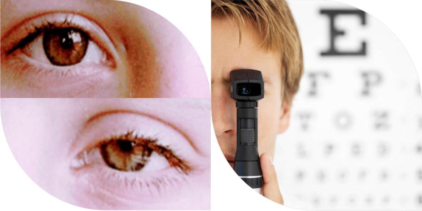 Oculo Pediatric Combined
